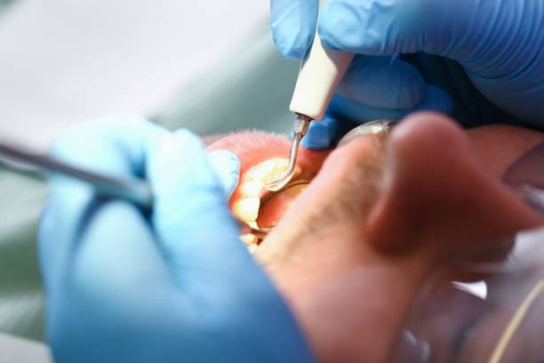 Best Knocked-Out Tooth Emergency  in Chouteau, OK