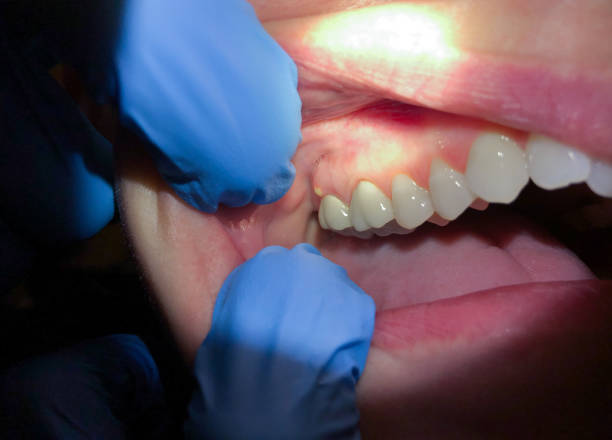 Best Affordable Emergency Dental Care  in Chouteau, OK