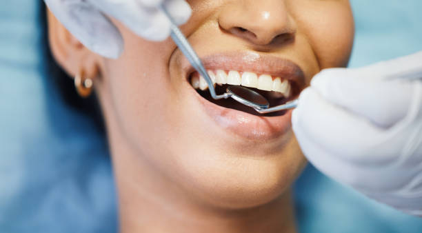 Best Urgent Tooth Repair  in Chouteau, OK