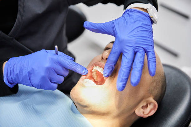 Best Affordable Emergency Dental Care  in Chouteau, OK